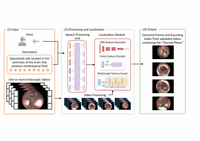 Publication of the NeuroLens paper in IJCARS